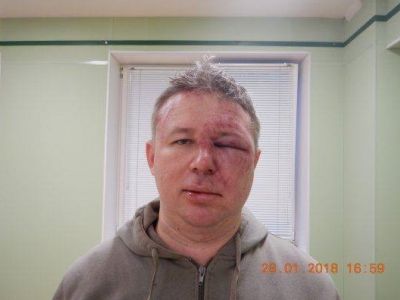 Правозащитник Динар Идрисов после нападения, 28.1.18. Источник - ovdinfo.org